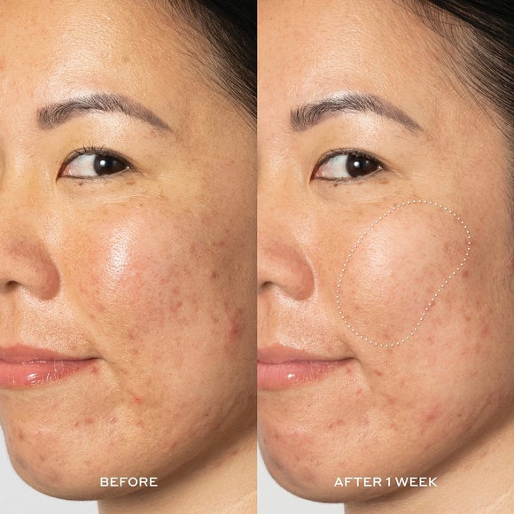 Ole Hendriksen Glow OH Dark Spot Toner - Picture 4 of 10